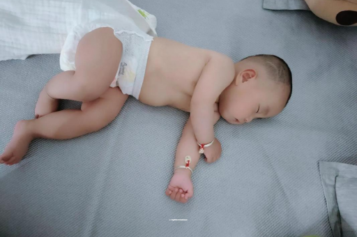 东平六个月宝宝眼睛散光